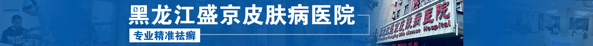 哈尔滨银屑病医院_哈尔滨牛皮癣医院哪家好_哈尔滨治疗银屑病专科医院-黑龙江盛京银屑病医院